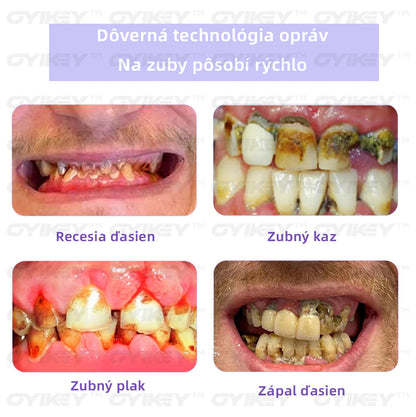 🦀𝐎𝐲𝐢𝐤𝐞𝐲™ 𝐎𝐛𝐧𝐨𝐯𝐚 𝐳𝐮𝐛𝐨𝐯 𝐌𝐢𝐧𝐞𝐫á𝐥𝐧𝐲 𝐩𝐫áš𝐨𝐤💋(SKZL odporúčané)