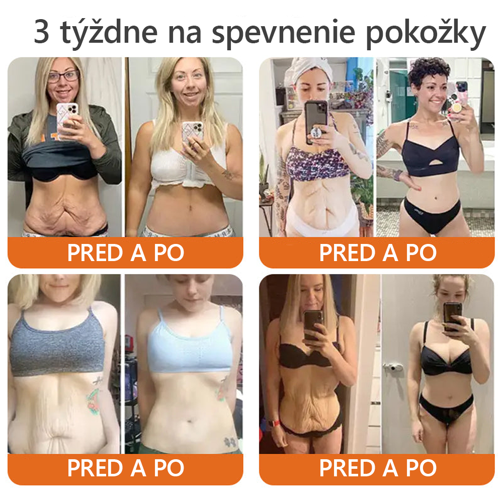 Vyrobené a odoslané zo Slovenska✨Dormorna® Včelí Jed kompletný krém 🔥 POSLEDNÝ DEŇ ZĽAVA 80 %.💎💎