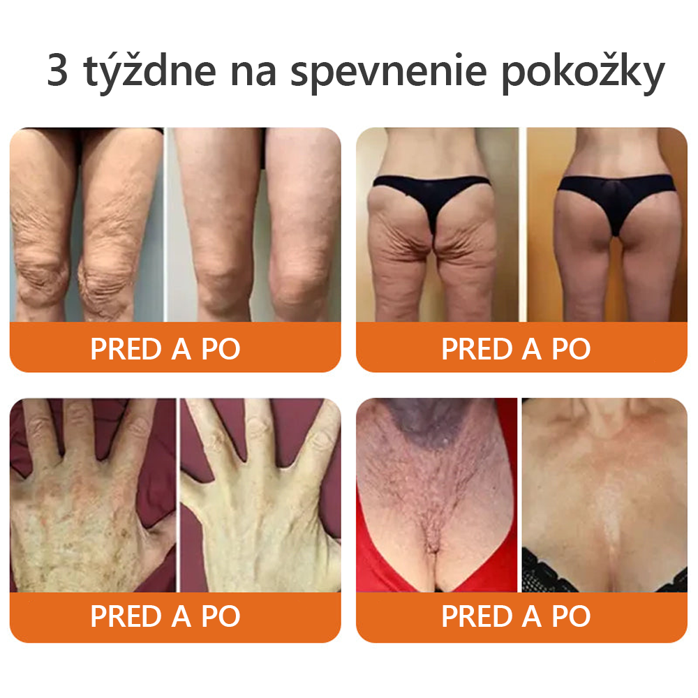 Vyrobené a odoslané zo Slovenska✨Dormorna® Včelí Jed kompletný krém 🔥 POSLEDNÝ DEŇ ZĽAVA 80 %.💎💎