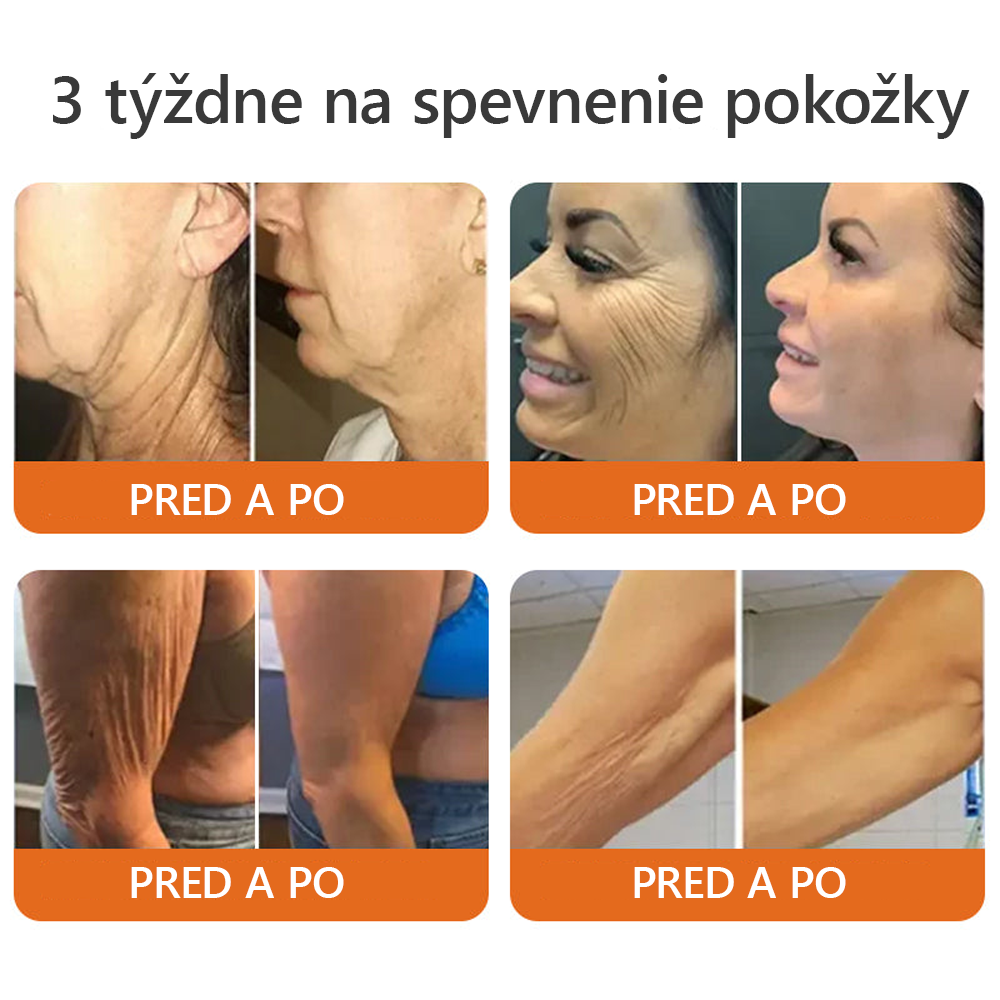Vyrobené a odoslané zo Slovenska✨Dormorna® Včelí Jed kompletný krém 🔥 POSLEDNÝ DEŇ ZĽAVA 80 %.💎💎