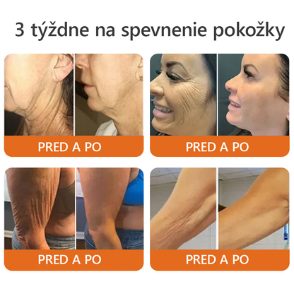 Vyrobené a odoslané zo Slovenska✨Dormorna® Včelí Jed kompletný krém 🔥 POSLEDNÝ DEŇ ZĽAVA 80 %.💎💎